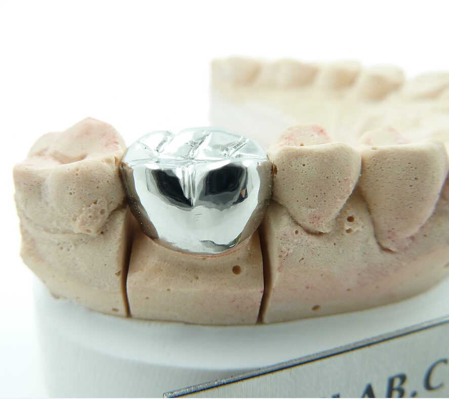 Flexible Denture